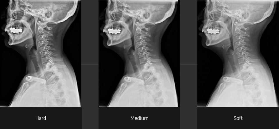 Cervical spine lateral Sample