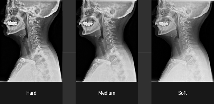 Cervical spine lateral Sample