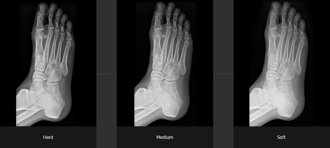 Foot oblique Sample