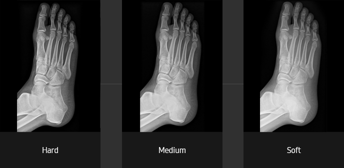 Foot oblique Sample