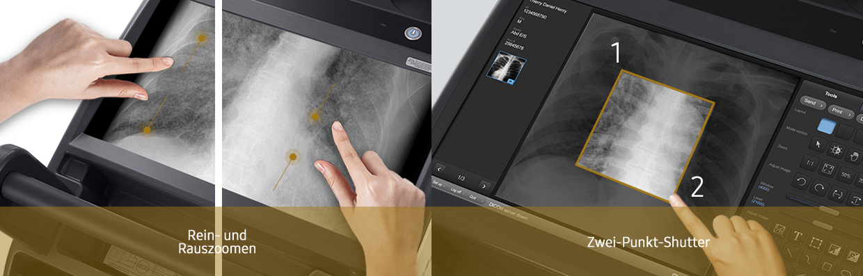 MTA/MTRA bedient das Multitouch Display des digitalen Röntgensystems GM85 von Samsung