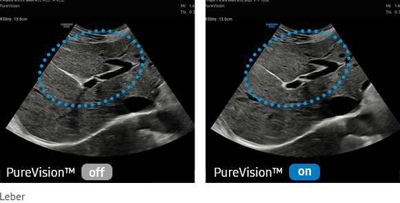 PureVision™