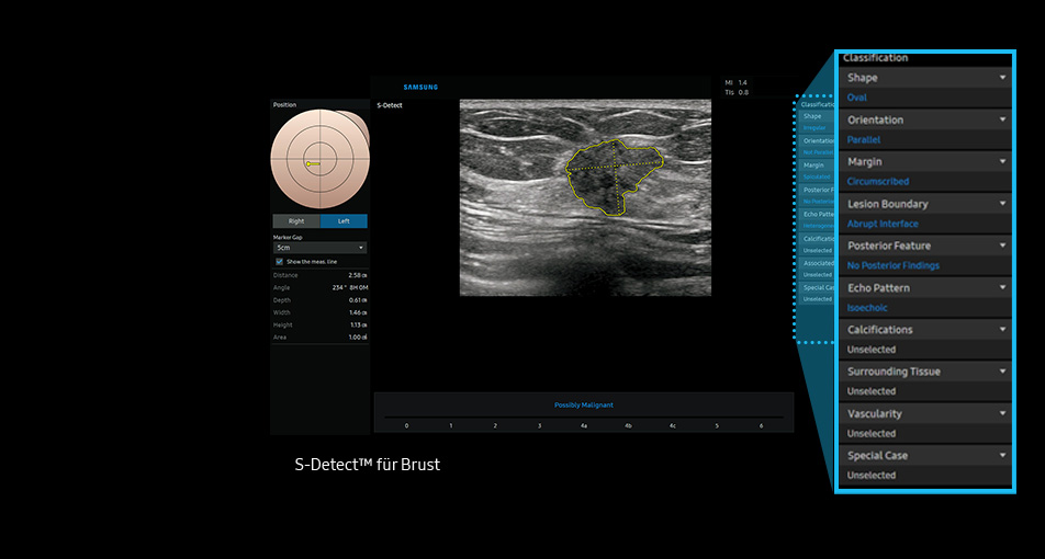 S-Detect™ für Breast