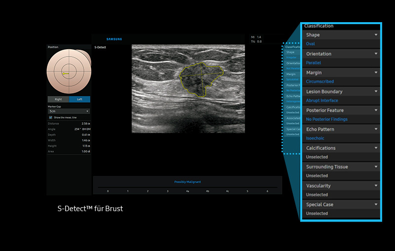 S-Detect™ für Breast