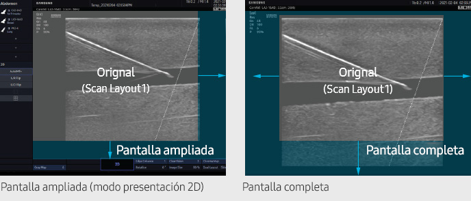 Pantalla ampliada (modo presentación 2D), Pantalla completa