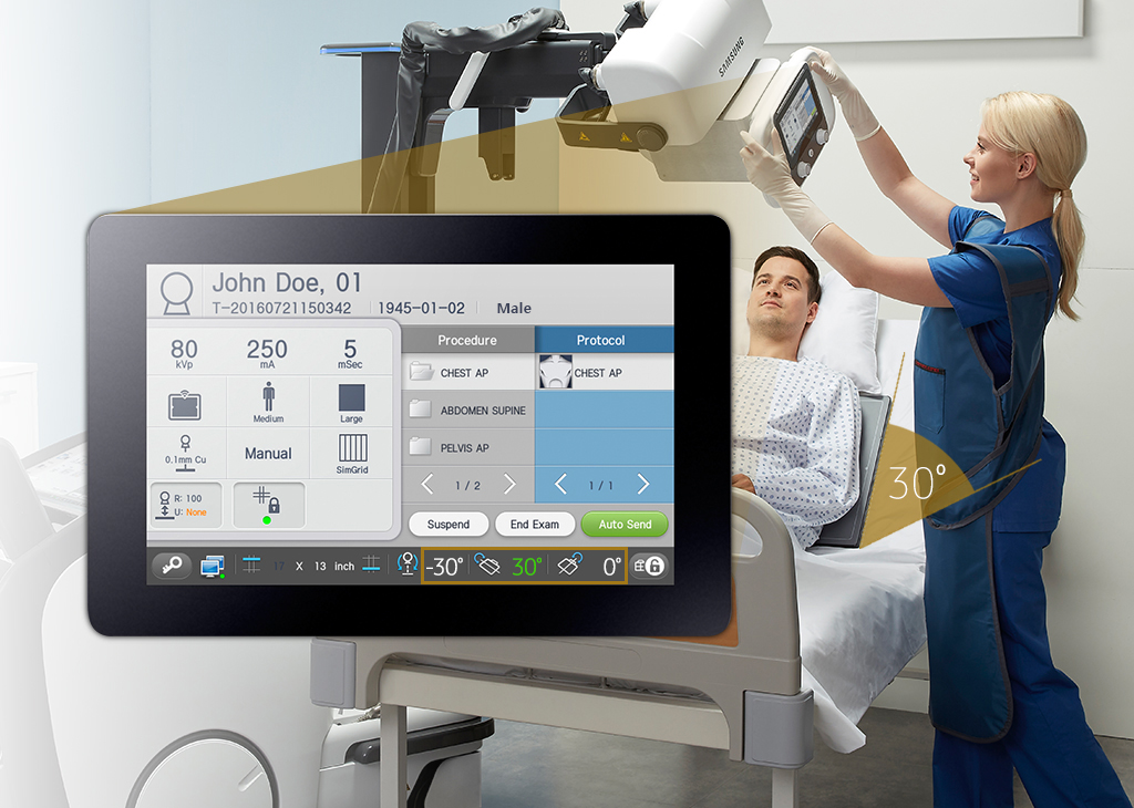 GM85-radiographie-benefices-s-align