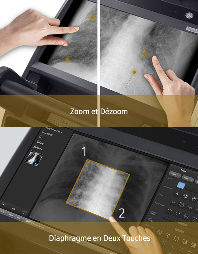 GM85-radiographie-benefices-multi-touches