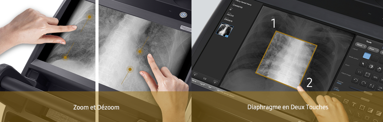 GM85-radiographie-benefices-multi-touches