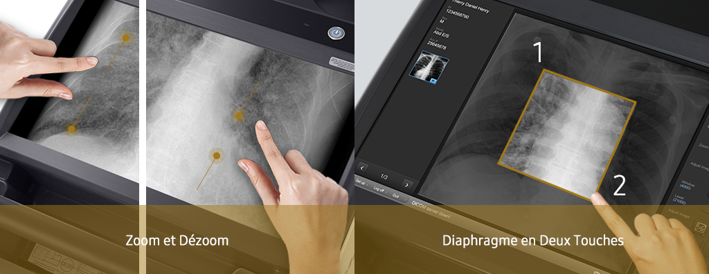 GM85-radiographie-benefices-multi-touches