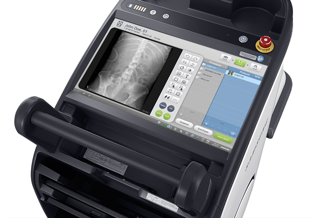 GM85-radiographie-benefices-s-vue