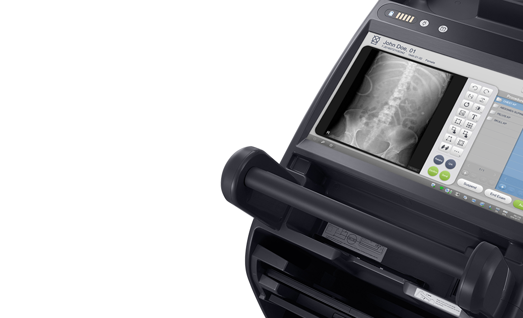 GM85-radiographie-benefices-s-vue