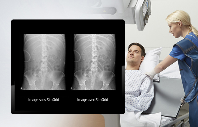 GM85-radiographie-benefices-simgrid