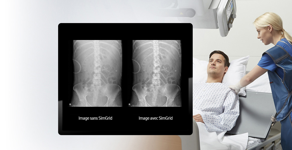 GM85-radiographie-benefices-simgrid