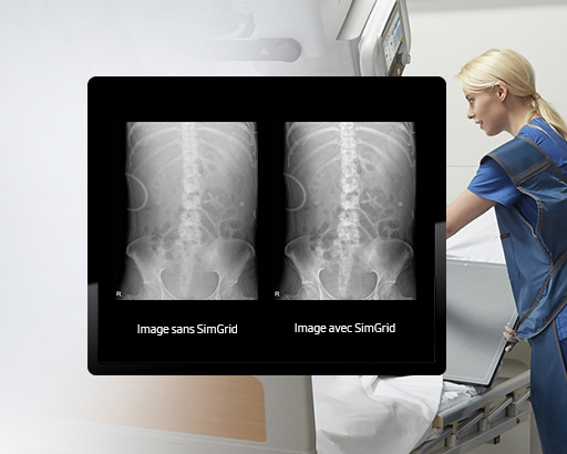 GM85-radiographie-benefices-simgrid