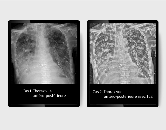GM85-radiographie-benefices-TLE