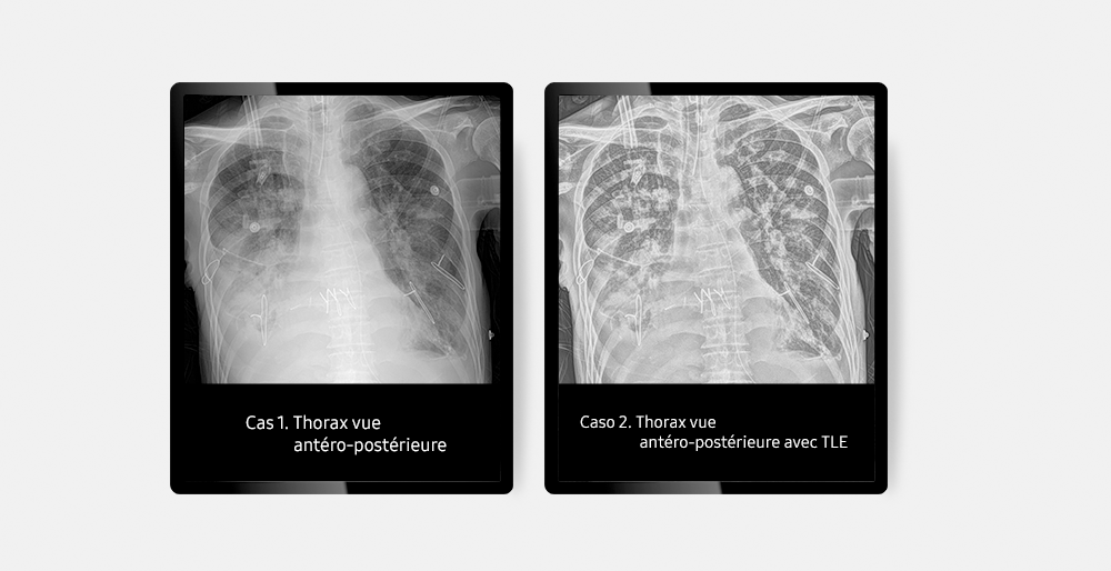 GM85-radiographie-benefices-TLE