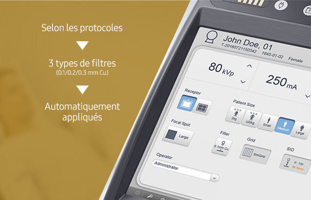 GM85-radiographie-benefices-filtre-automatique