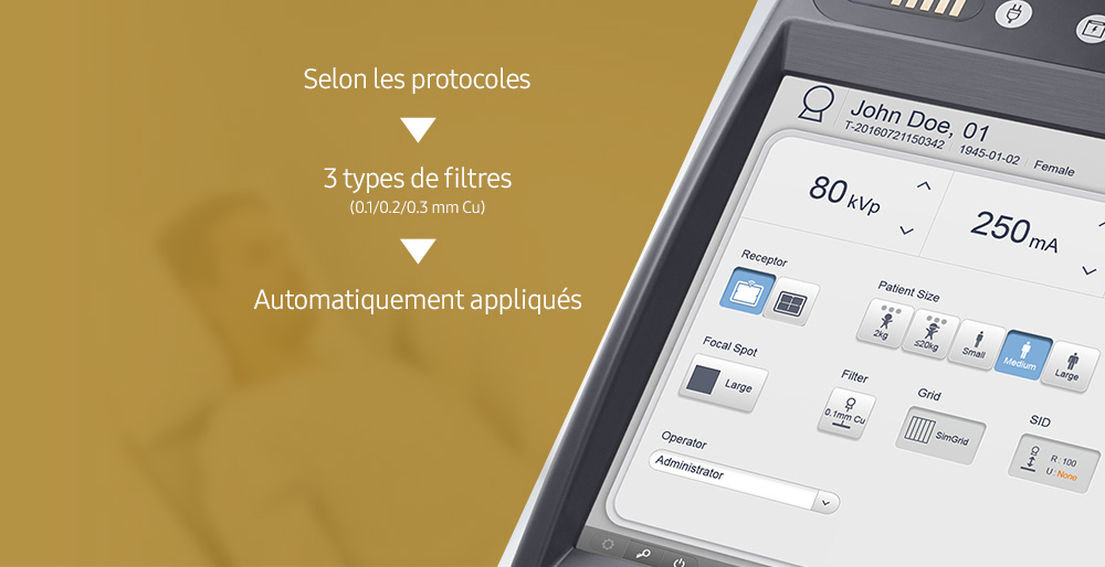 GM85-radiographie-benefices-filtre-automatique