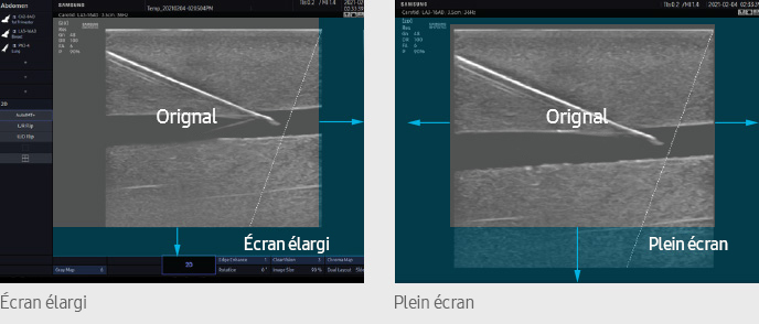 Écran élargi, Plein écran
