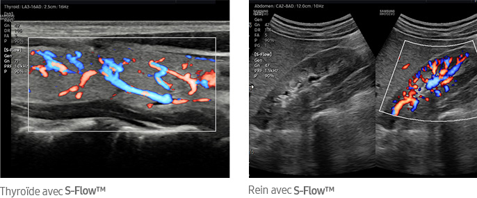 Thyroïde avec S-Flow™, Rein avec S-Flow™