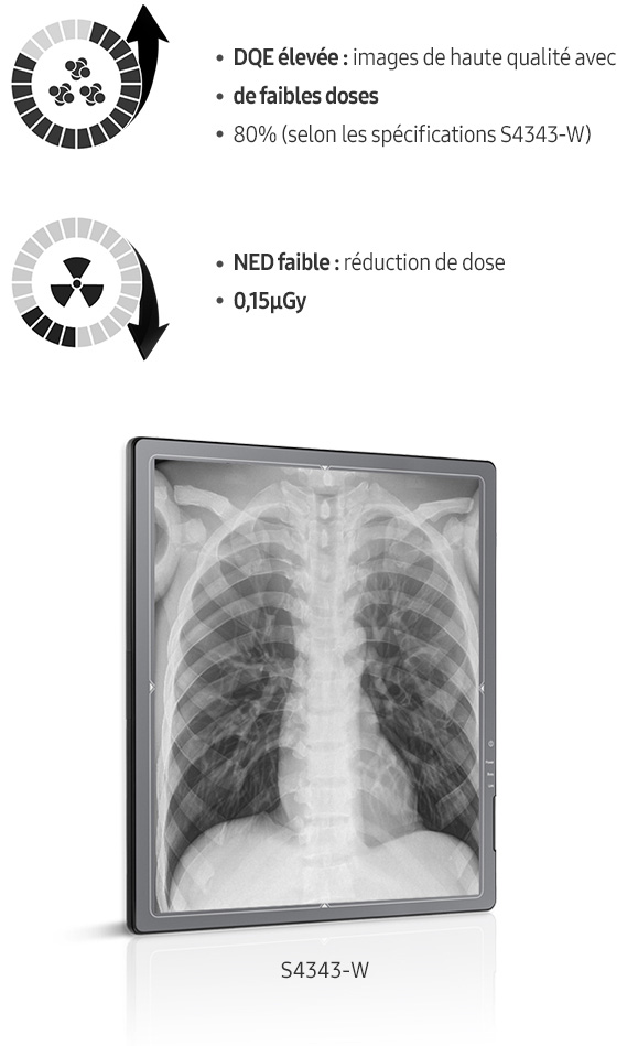 S-detector-radiographie-benefices-images claires-DQE-elevee