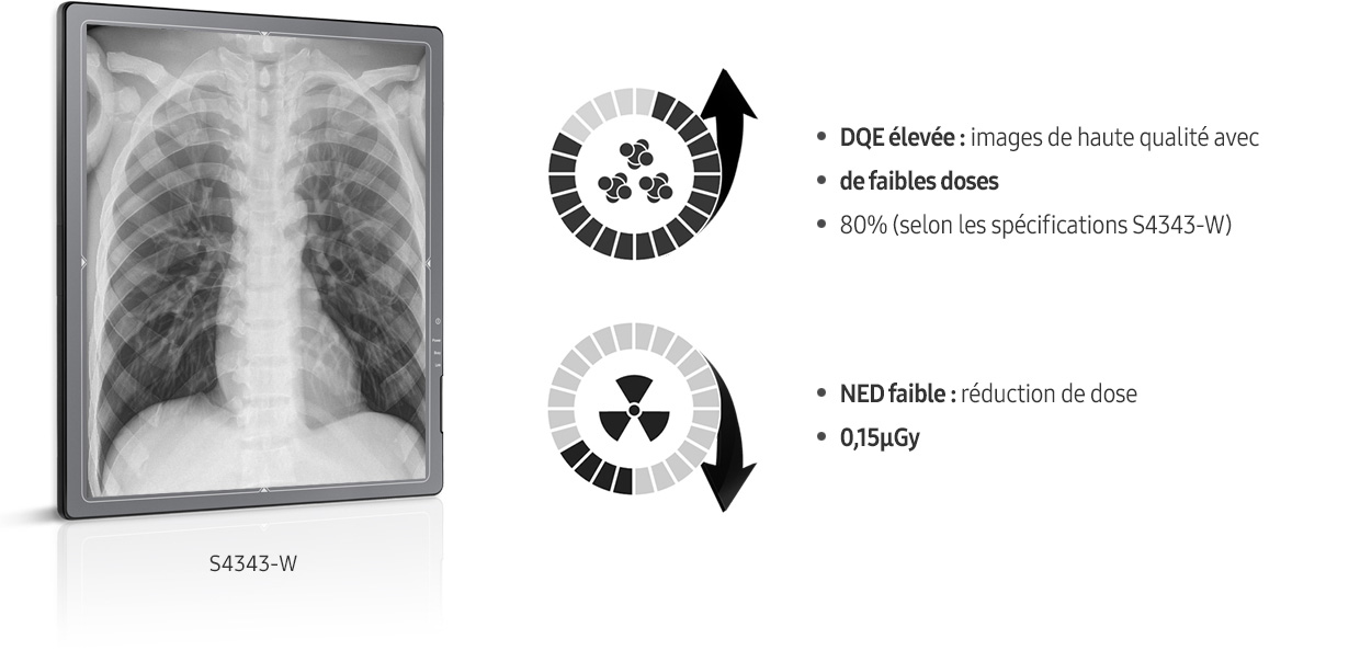 S-detector-radiographie-benefices-images claires-DQE-elevee