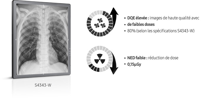S-detector-radiographie-benefices-images claires-DQE-elevee