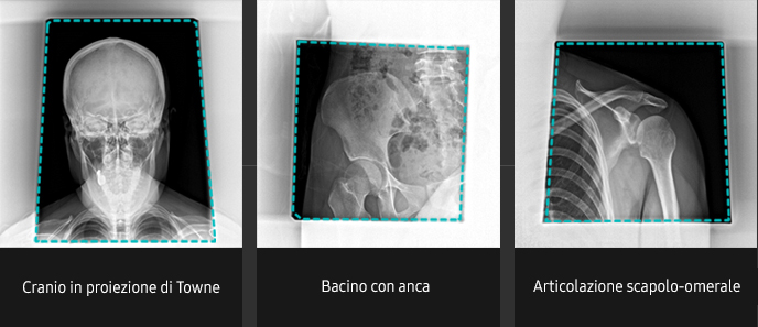 S-Vue-radiographie-benefices-qualite-image-diaphragme-automatique