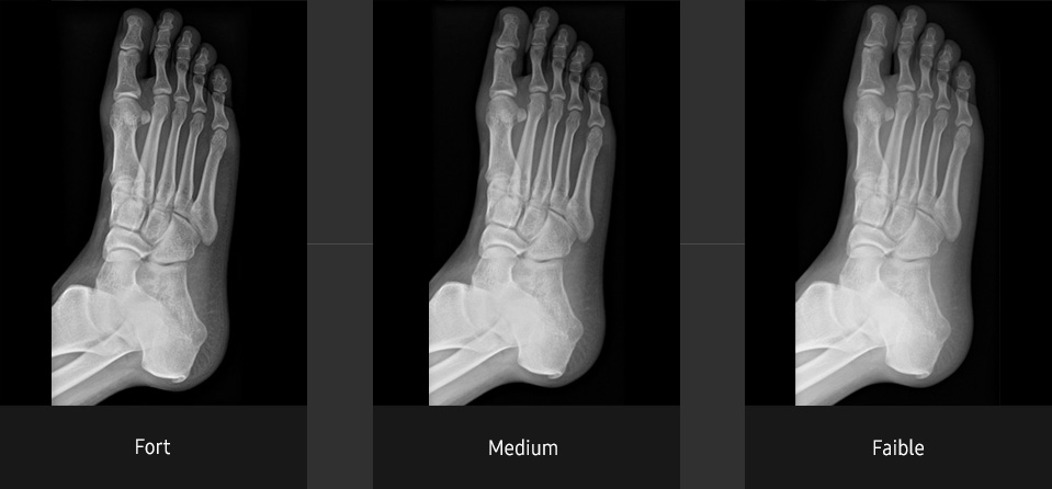 S-Vue-radiographie-benefices-ajustement-contraste-pied