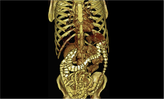 Anatomia dell'addome