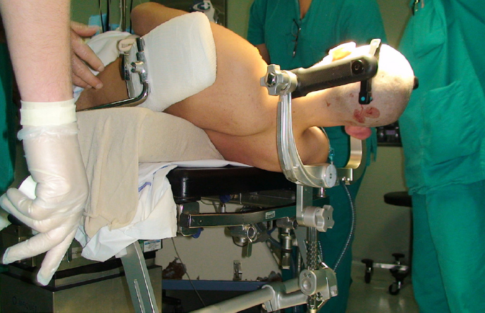 fissaggio affidabile della testa del paziente durante l'esame diagnostico