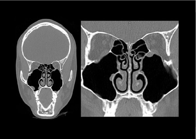 Risultato dell'esame diagnostico