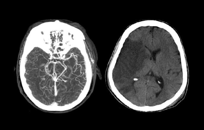 risultato dell' esame diagnostico fatto sul cranio