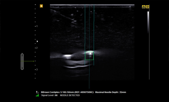 In-Plane (Phantom) Sample