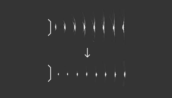 S-Vision Beamformer riceve segnali di ritorno attraverso un sofisticato sistema di filtraggio digitale, con conseguente riduzione dei lobi laterali e degli artefatti.