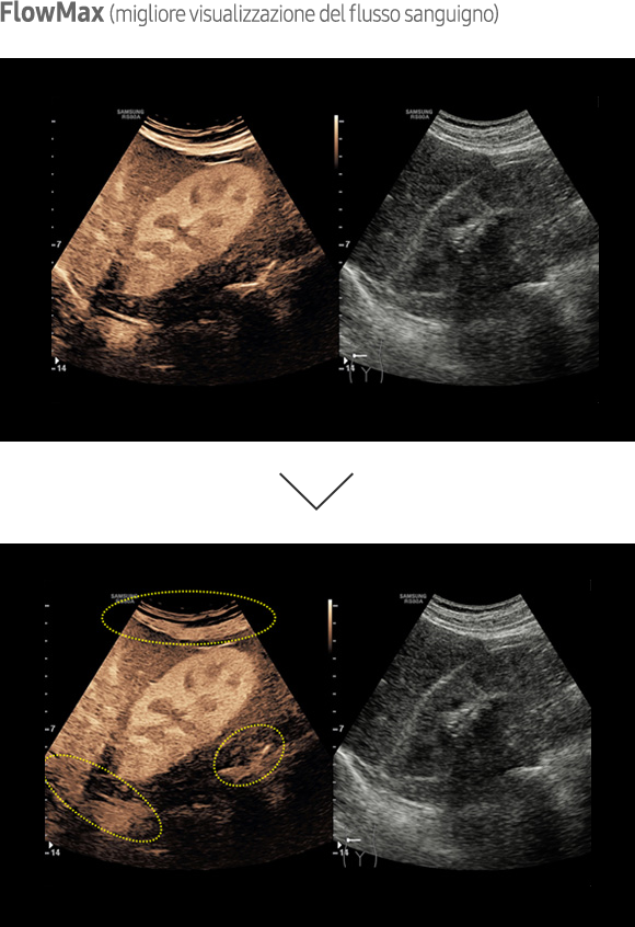 Immagine ottenuta con software CEUS+