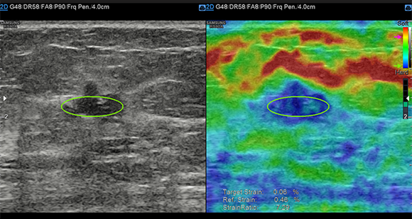 Immagini ottenute con software E-strain