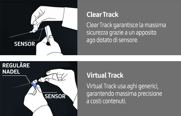 S-Tracking 