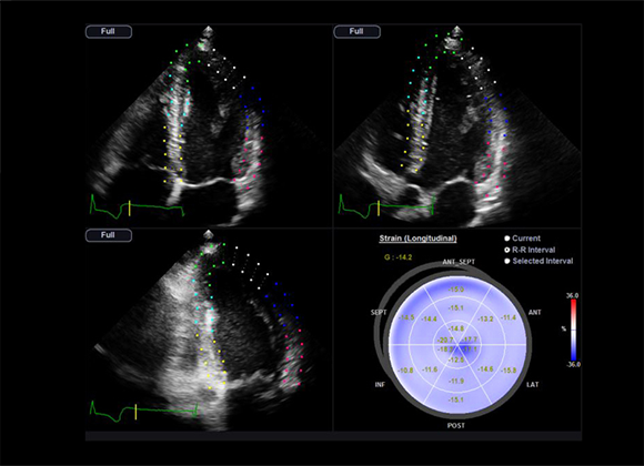 Valutazione ottenuta con software Strain+ 