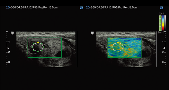 Immagini ottenute con software E-strain