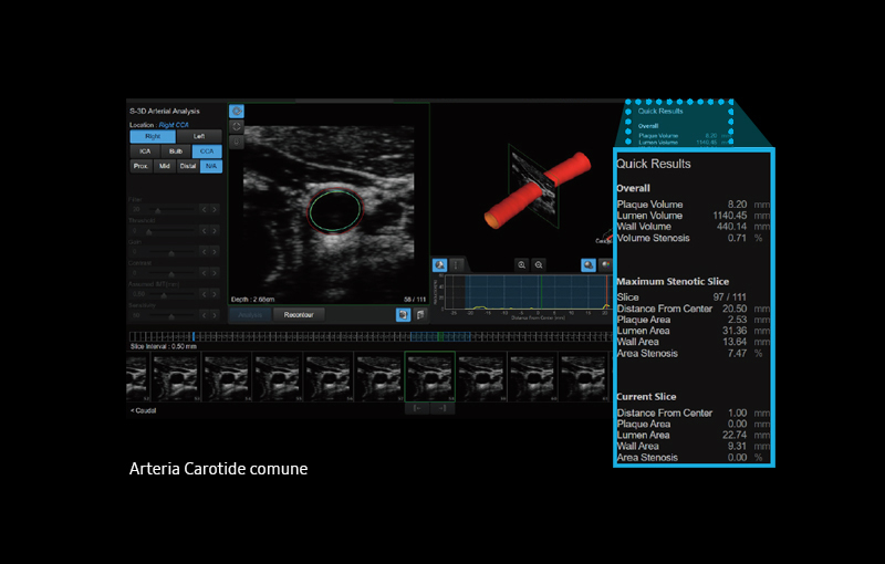 S-3D Arterial Analysis™