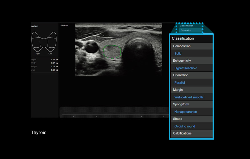 S-Detect™ for Thyroid™