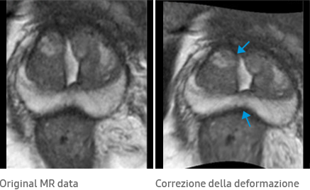 Original MR data, Correzione della deformazione