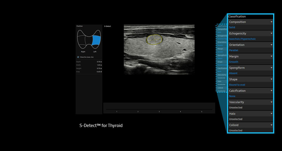 sdetector™ for Thyroid