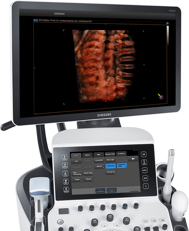 Ecografo in funzione con software in funzione Crystal Vue™