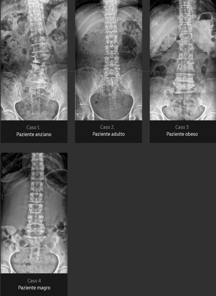 Immagini radiografiche in diverse condizioni di esame