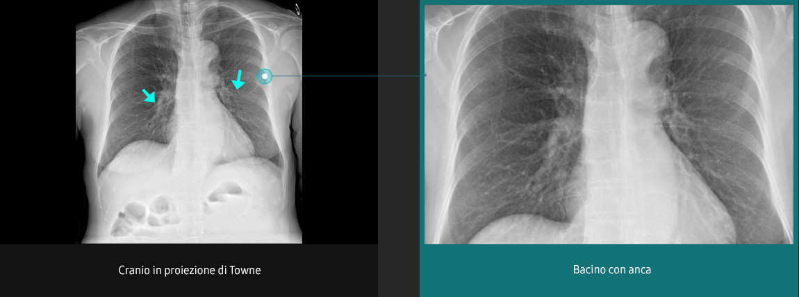 Immagini radiografiche in diverse condizioni di esame con elevata definizione e chiarezza