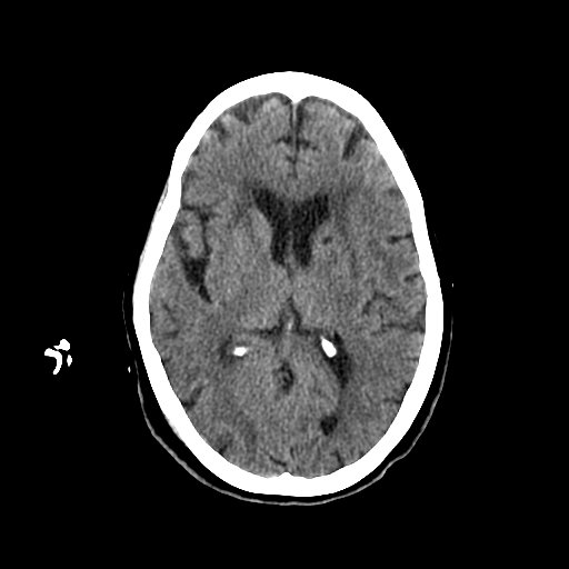 BodyTom-Brain-1