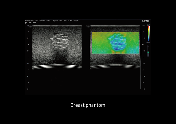 ElastoScan™Sample