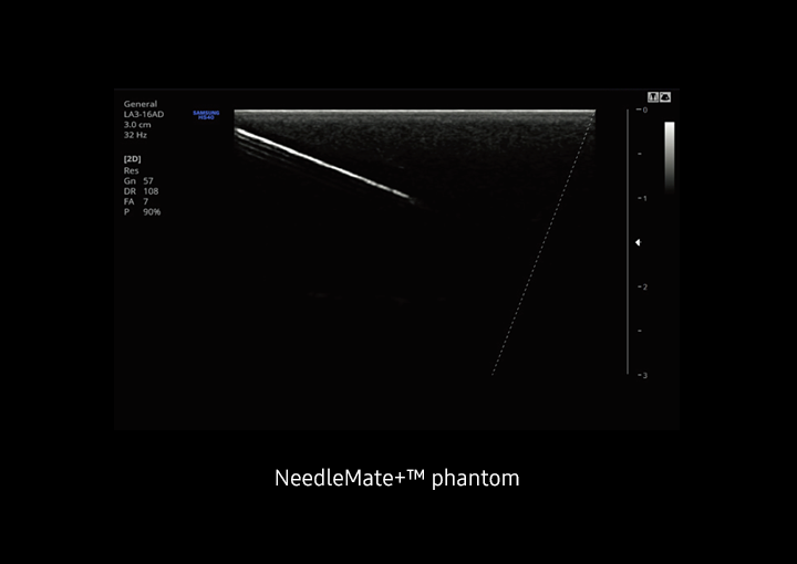 NeedleMate+ Sample